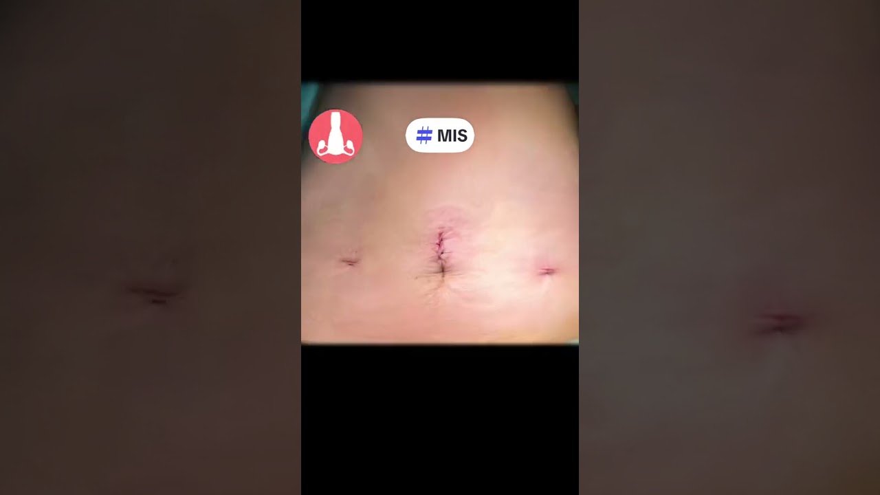 Zaniru Raúl Marín Martínez-7