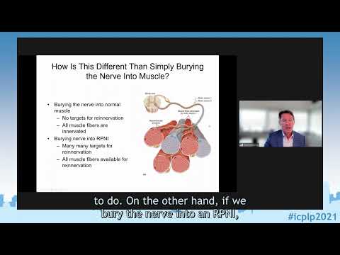 ICPLP2021 - Prof. Cederna: Use of RPNIs for the Prevention and Treatment of Neuroma and Phantom Pain