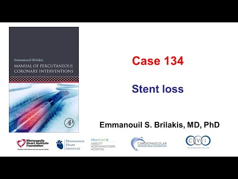 Case 134: Manual of PCI - Stent loss