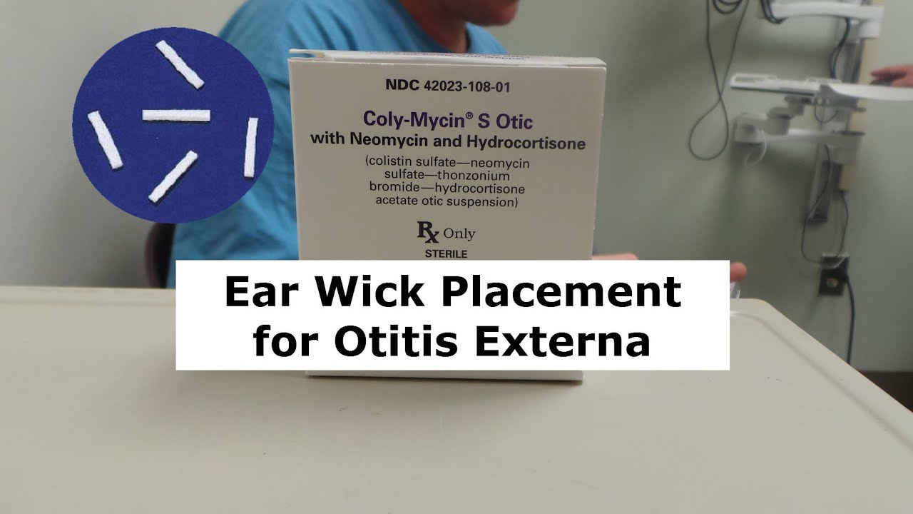 Ear Wick Placement for Otitis Externa - YouTube