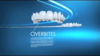preview picture of video 'Invisalign Braces Treat A Broad Range Of Dental Issues'