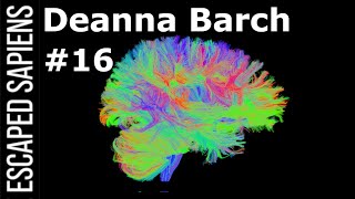 #16 Deanna Barch | This Is How Your Brain Works.