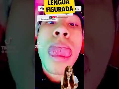 Lengua fisurada 👅😜