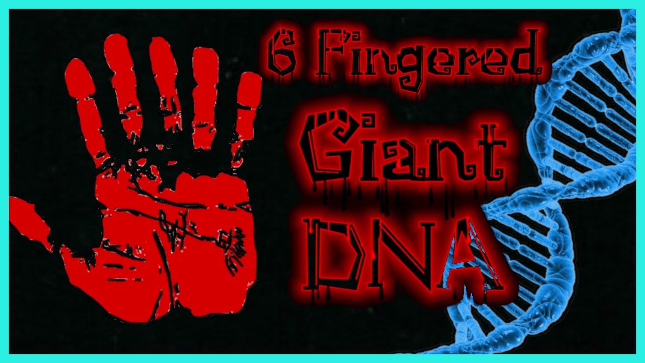 The Six Finger Giant DNA Has Been Found (& Elongated Skulls)