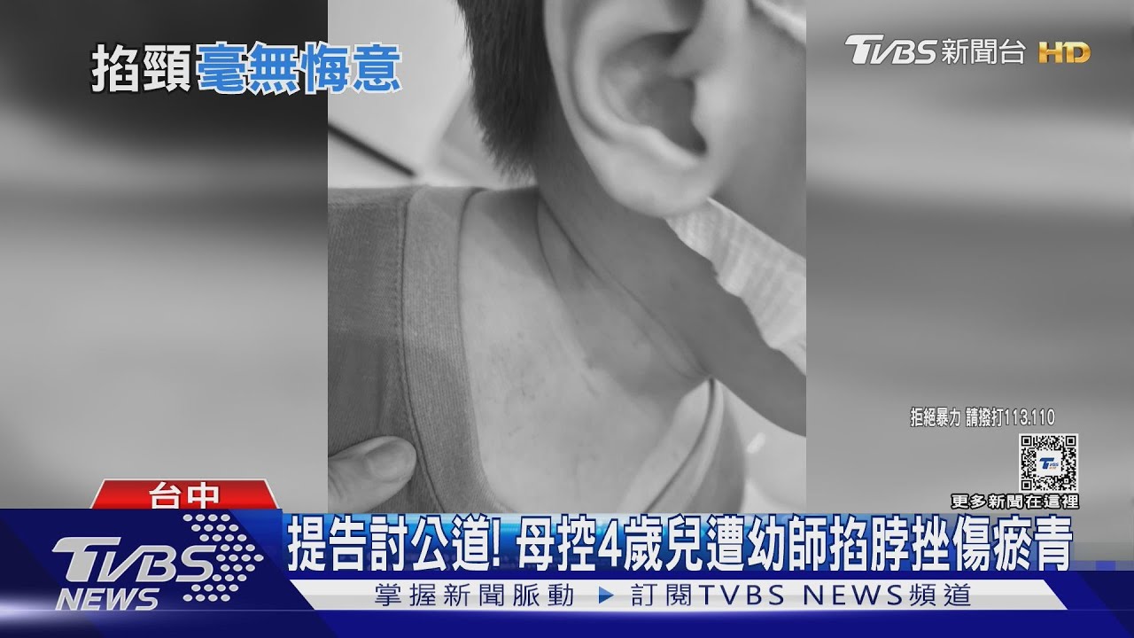 提告討公道!母控4歲兒遭幼師掐脖挫傷瘀青