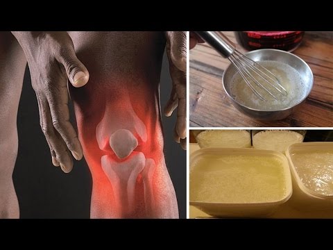 Artroza tratamentului chistului articulației brutarului la genunchi