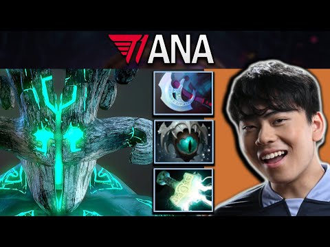 Juggernaut Dota 2 Gameplay T1.Ana with Manta and Skadi