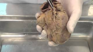 The Coronary Arteries