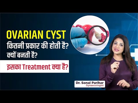 Ovarian cyst कितनी प्रकार की होती है? क्यों बनती है ? इसका treatment क्या है ?