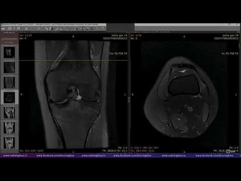 Lecția de genunchi 19