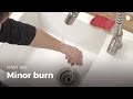 Learn first aid gestures: Minor Burn