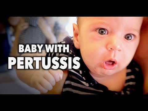 BABY WITH PERTUSSIS! (Whooping Cough) | Dr. Paul