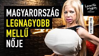 "Inkább meghalok, minthogy kisebb mellekkel éljek" | LEVENTE KLUBJA