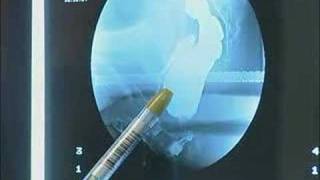 Dr. Jonathan Cohen - What is Gastroenterology