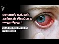 What Are The Common Causes Of Eye Redness In Tamil தமிழ் Empty Idea