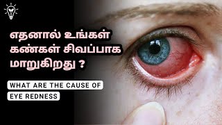 What Are The Common Causes Of Eye Redness In Tamil | தமிழ் | Empty Idea