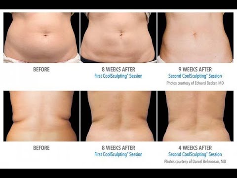 Infus dari diet grapefruit Cara menghapus perut latihan lemak bagi perempuan