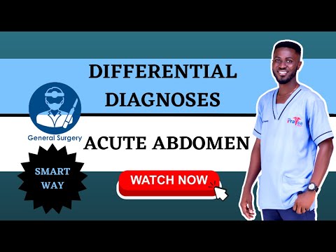 Acute Abdomen: THIS IS HOW TO LEARN THE CAUSES OF ACUTE ABDOMEN
