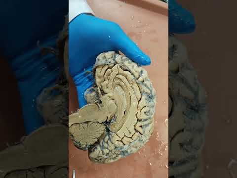 Sistema límbico: neuroanatomía macroscópica.