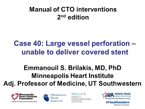 Case 40: Manual of CTO Interventions - Perforation during retrograde CTO PCI