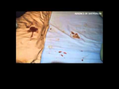 Video thumbnail for Rats Sniff Out Poison