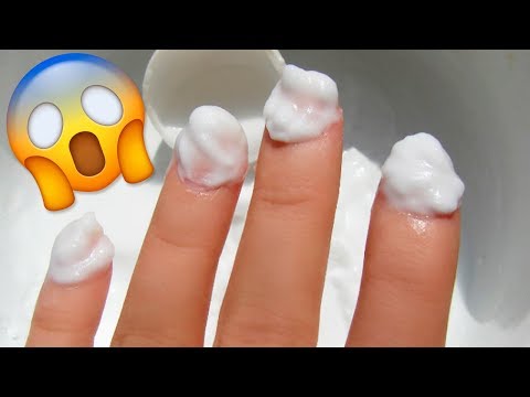 Nangangahulugan mula sa tainga halamang-singaw Ang halamang-singaw sa pagitan ng toes paa video