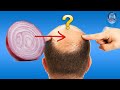 DOES ONION JUICE REALLY WORK FOR HAIR LOSS TREATMENT Natural Hair Loss Remedies