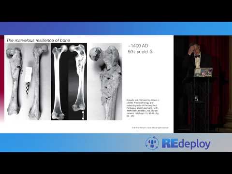 A Few Observations on the Marvelous Resilience of Bone & Resilience Engineering - Dr. Richard Cook
