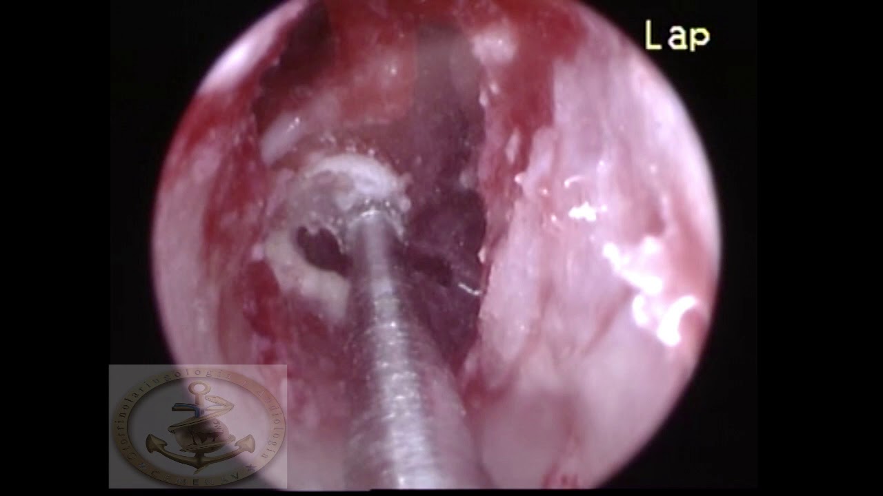 Francisco Javier Mancilla Mejía-0