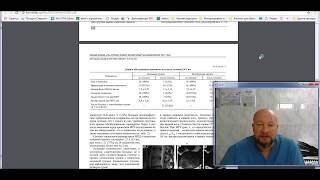 Про самозаживление грыж