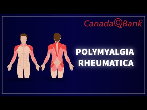 Polymyalgia Rheumatica: Symptoms, Diagnosis & Treatment | Rheumatology Explained | CanadaQBank