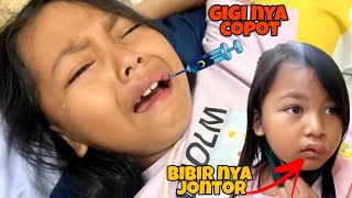 REVINA JATOH SAMPAI GIGI DAN BIBIR NYA JONTOR 😱 GIGI REVINA COPOT