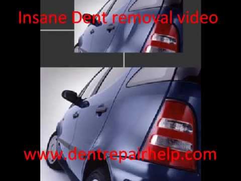 Insane Dent removal video - Painless Dent Removal
