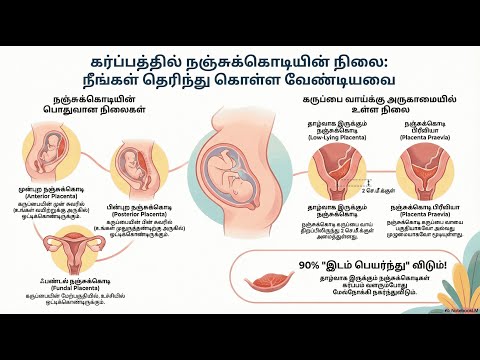 Placental Location — video thumbnail