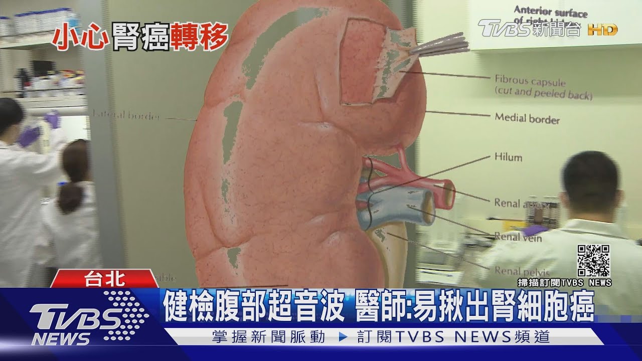 輕忽這幾種症狀!延誤就醫確!診「腎細胞癌」 醫警告治療難度高!