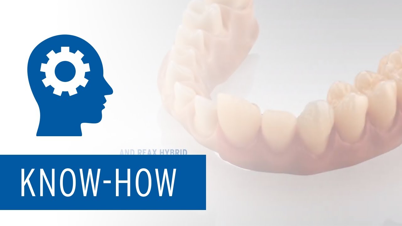 REAX Hybrid Bridges – Design implant-supported bridges with gingiva parts in record time