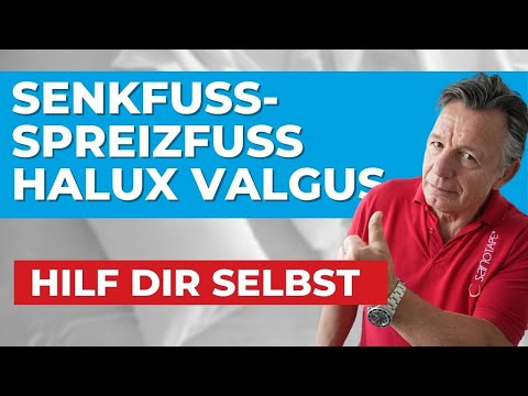Senkfuß - Spreizfuß - Hallux Valgus | So bist du schmerzfrei! 🍀