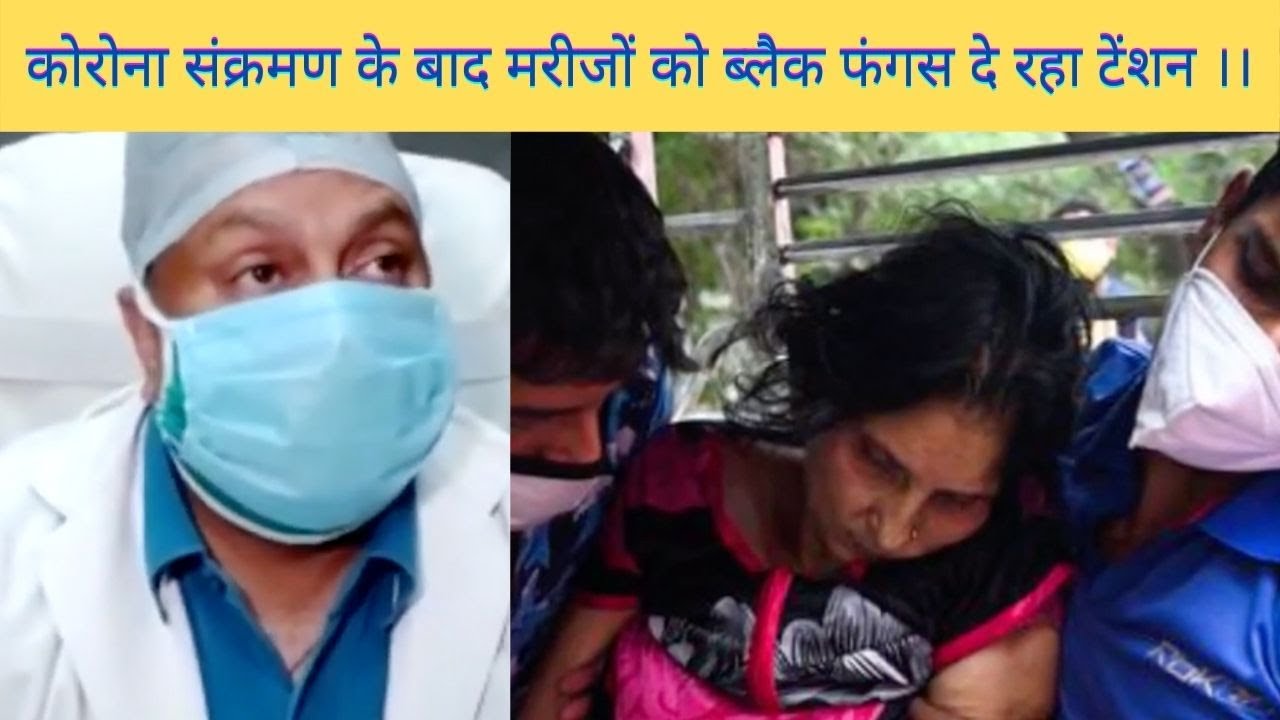 ये एक फंगस है ना कि वायरस और ये फंगस कोरोना वायरस का ही एक रूप है।