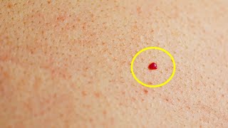 Do You Have Red Spots On Your Skin? Here