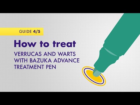 How to treat verruca's and warts with Bazuka Advance Treatment Pen