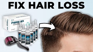 Men: How To Fix Hair Loss At Home (Full Guide)