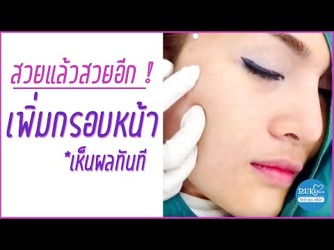 ร้อยไหม หน้าเรียว