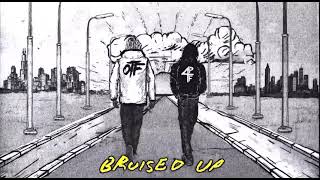 Download lagu Lil Durk & Lil Baby - Bruised Up ( Video Audio) [V.O.T.H Album] mp3
