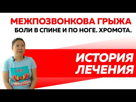 Межпозвонковая грыжа Острые боли в спине, отдающие в ногу.