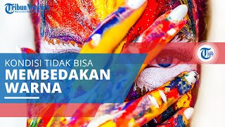Buta Warna, Kondisi Mata yang Menyebabkan Penderitanya Tak Bisa Membedakan Warna Satu dengan Lainnya