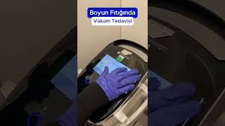 Boyun Fıtığında Vakum Tedavisi #fiziktedavi #fiziktedaviverehabilitasy