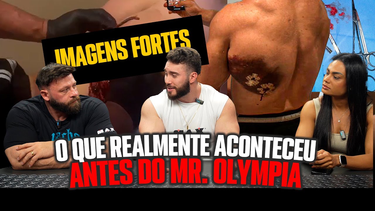 THE TRUTH ABOUT MY BACK NUMBER BEFORE OLYMPIA