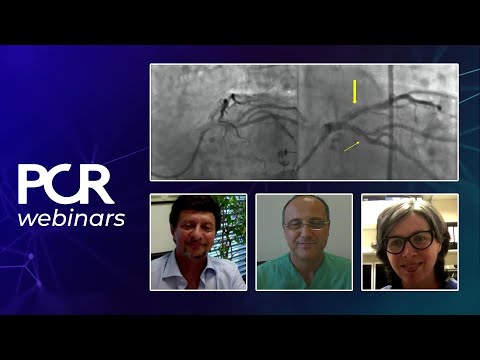 How should I treat calcified lesion involving a bifurcation side branch? - Webinar