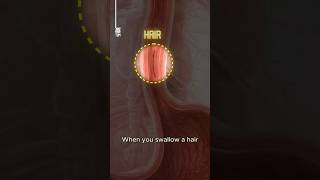 What Happens to Swallowed Hair