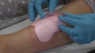Product video: ALLEVYN Gentle Border Wound Dressings